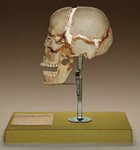 cranio sacral